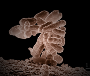 E-Coli and coliform treatment. These bacterium indicates the presence of fecal matter. And they are both harmful bacteria